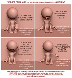 Плакат медицинский по распознаванию инсульта (инфографика)
