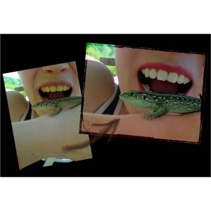 Цифровое отбеливание зубов
